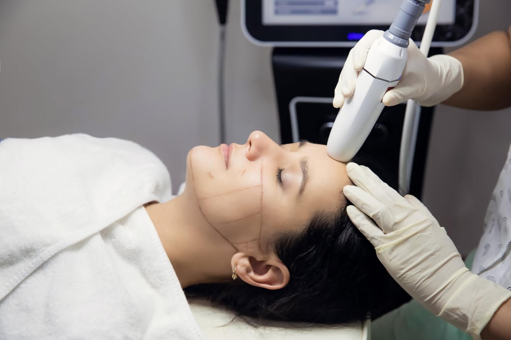 7D HIFU face lifting treatment with non-invasive ultrasound technology to tighten skin, lift facial contours, and improve elasticity